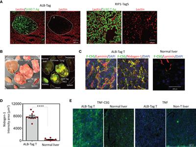 ECM Depletion Is Required to Improve the Intratumoral Uptake of Iron Oxide Nanoparticles in Poorly Perfused Hepatocellular Carcinoma